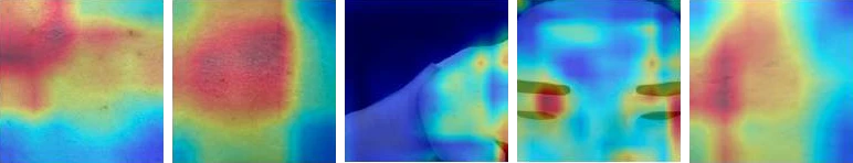 Grad-CAM attention maps of the VGG16 model for the same photos